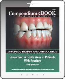 Prevention of Tooth Wear in Patients With Bruxism Ebook Cover