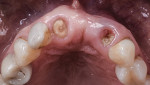 Fig 10. Occlusal view at presentation.