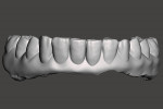 Fig 15. The STL file of the designed “taco shell” denture.