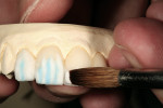Figure 15  Segmental enamel layering was accomplished with a low-value opal and a high-value tagged blue enamel powder.
